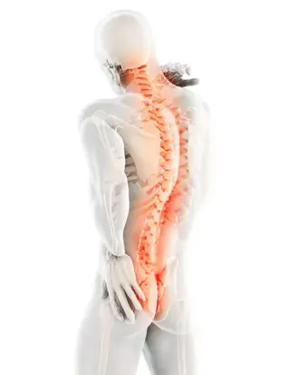 back pain concept