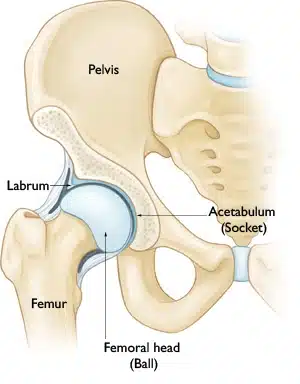 hip pain in plantation