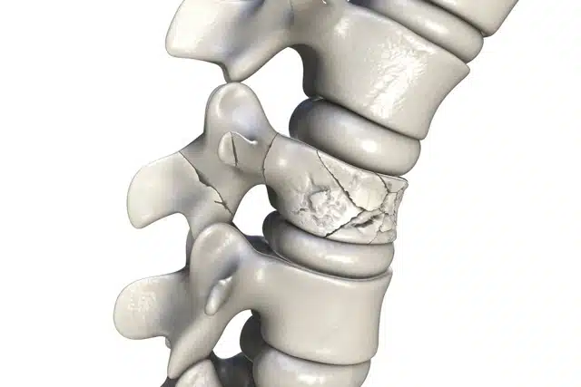 Spinal chord